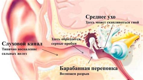 Аккумуляция слизи в ушном канале