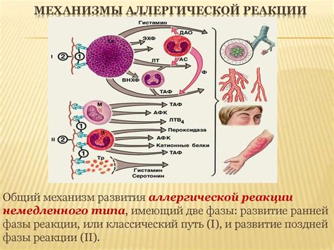 Аллергические реакции и их влияние на состояние здоровья ребенка