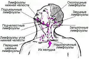 Альтернативные приемы для борьбы с воспалением лимфатических узлов в области горла