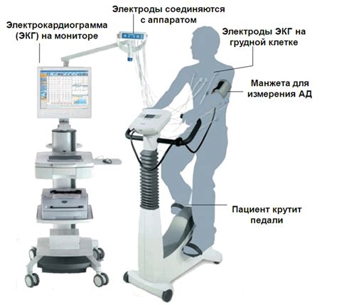 Анализ показателей ЭКГ с проведением физической нагрузки: на что обратить внимание