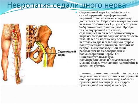 Анатомическая особенность седалищного нерва