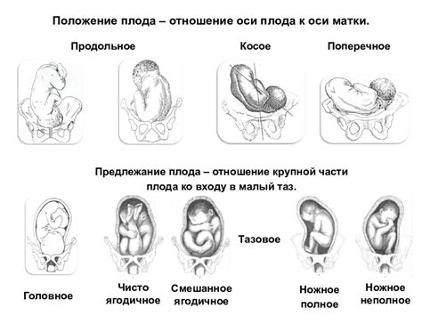 Аномалии развития плода как основная причина дистресса мозговой деятельности у плода 22 недель