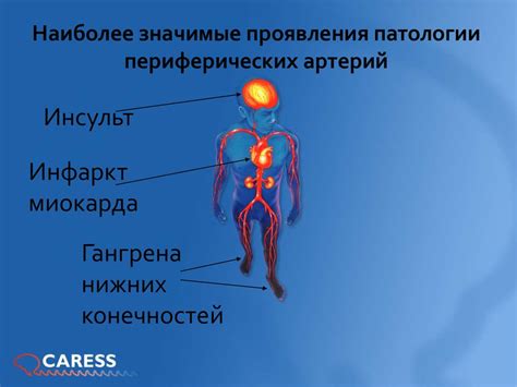 Болезни, обуславливающие нарушение функционирования конечностей