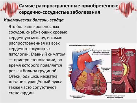 Влияние валериановой настойки на функционирование сердечно-сосудистой системы