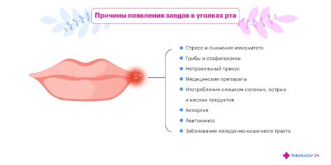 Влияние внешних факторов на появление ран и трещин в уголках рта