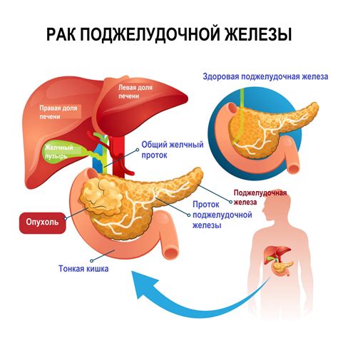 Влияние гормонального фона на функционирование поджелудочной железы