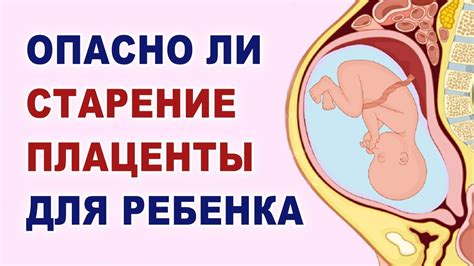 Влияние зрелости плаценты 1 степени на состояние здоровья матери и развитие плода