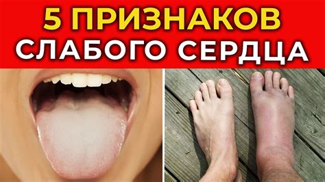 Влияние избытка соли на здоровье: проблемы с сердечно-сосудистой системой и отеки