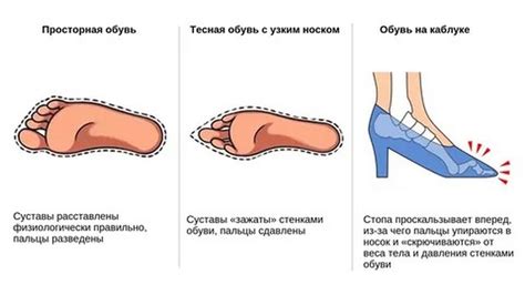 Влияние неправильной регулировки натяжения на характеристики шва