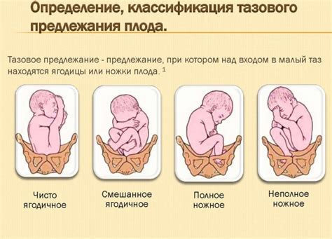 Влияние позиции головы плода на процесс родов