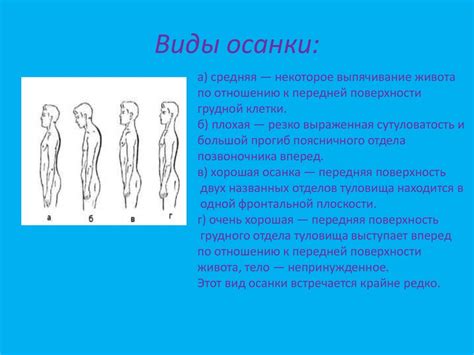 Влияние правильной осанки на появление шейной остеохондроза