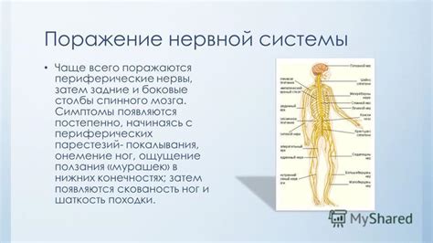 Влияние расстройств нервной системы на ощущение жгучего дискомфорта в нижних конечностях