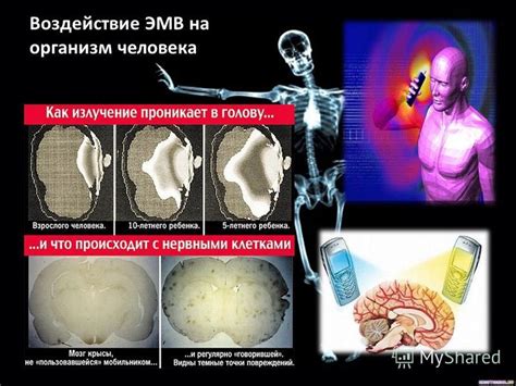 Воздействие электрических параметров на организм человека