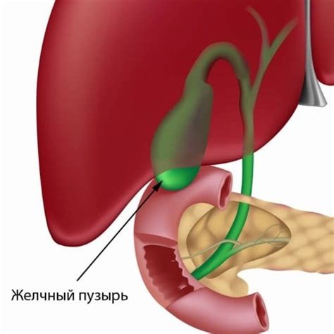 Возможные методы лечения гомогенного содержимого желчного пузыря