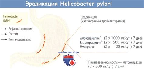 Возможные осложнения при недостаточно своевременном лечении инфекции, вызванной Helicobacter pylori