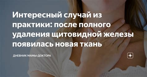 Восстановление контактов после полного удаления