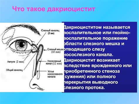 Врожденная особенность глазной анатомии