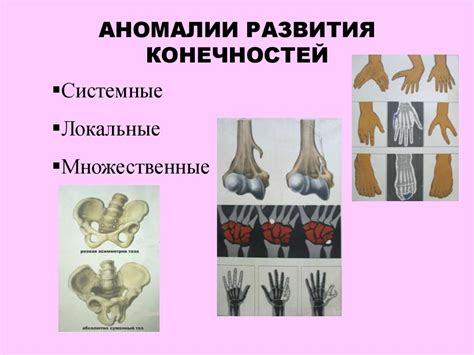 Врожденные аномалии структуры костей и суставов