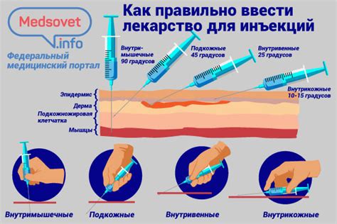 Выбор подходящего места для инъекций на ягодицах