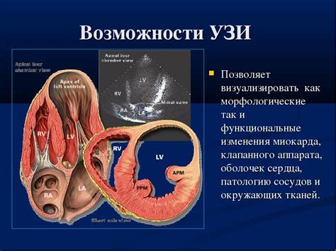 Выявление скрытых форм сердечной патологии