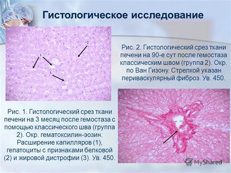 Гистологическое исследование после лапароскопии