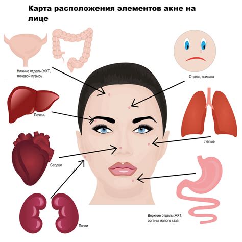 Гормональный дисбаланс: основная причина высыпаний на лице