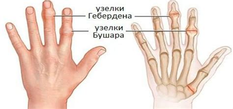 Деятельность, которую необходимо избегать при получении раны на первом пальце левой руки