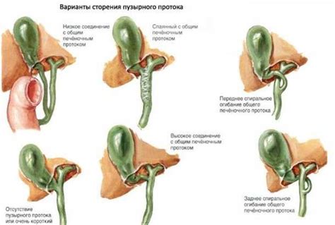 Диагностика гомогенного содержимого желчного пузыря