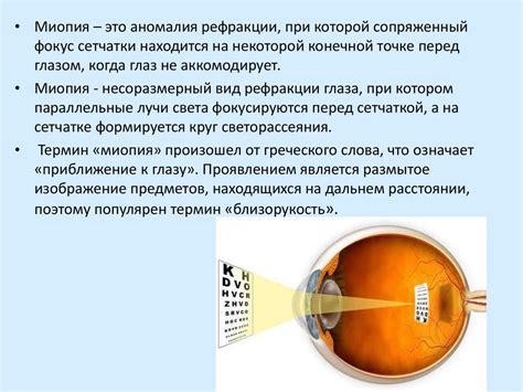 Диагностика миопии: новейшие методы и процедуры