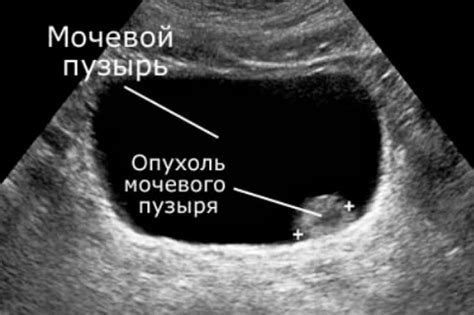 Диагностика простуды мочевого пузыря у щенка: как обнаружить проблему