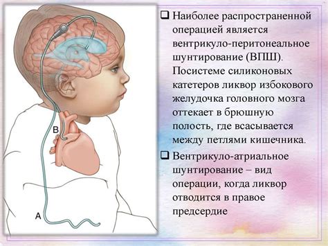 Диагностика состояния мимической внешней гидроцефалии