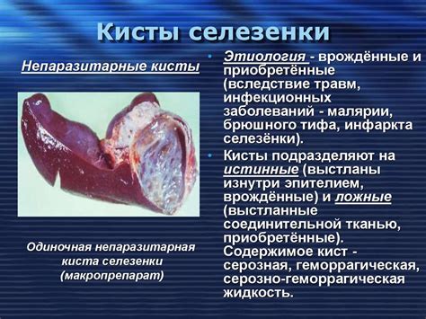 Заболевания селезенки, связанные с неправильным питанием