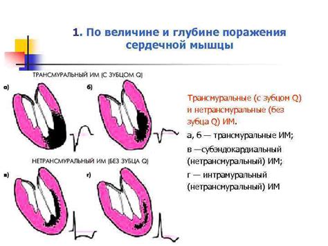 Значение электрокардиографии в обнаружении аномалий сердечной мышцы