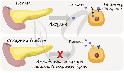 Инсулин и поджелудочная железа: взаимосвязь и роль гормона в организме