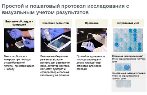 Интерпретация результатов микробиологического исследования мочи