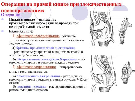 Инфекции, травмы и операции: факторы, способствующие сужению таза