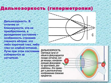 Как работает глаз и почему возникает эффект "видения в тумане"