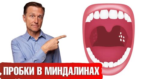 Как распознать казеозные пробки и какие проблемы они могут вызвать