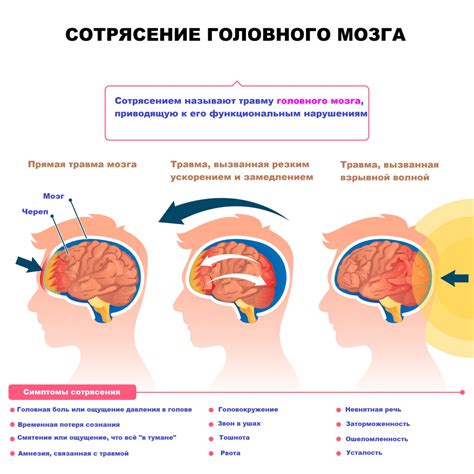 Как распознать признаки потрясения мозга и когда обратиться за помощью