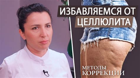 Классический метод борьбы с видимыми признаками целлюлита: основные методы