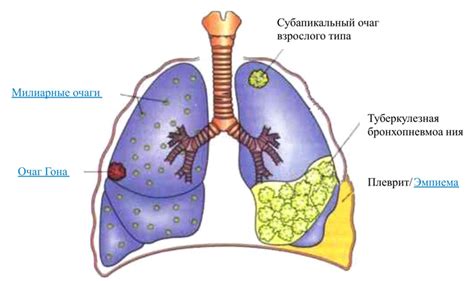 Клинический образ очага сгущения в тканях легкого