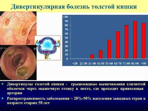 Лечение некоторых заболеваний