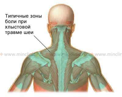 Локализация болевых ощущений - важный аспект для выявления источника дискомфорта