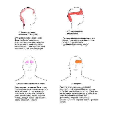 Меры предосторожности и особенности лечения головной боли после прививки Спутник V