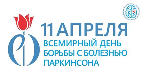 Методы борьбы с болезнью суставов верхних конечностей: путь к выздоровлению