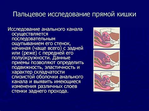 Методы восстановления и улучшения функциональности прямой кишки