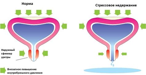 Методы эффективного устранения трещинок на области половых губ