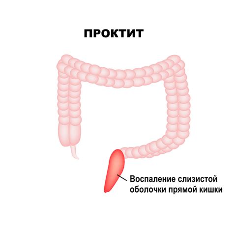 Мышечные слои прямой кишки