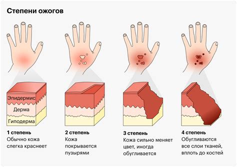 Ожоги и воспаление слизистой при употреблении васаби ложкой