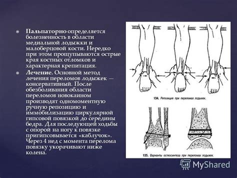 Описание феномена отека в области лодыжки и его возникновение